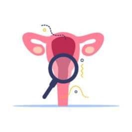 Illustrazione stilizzata dell’apparato riproduttivo femminile con lente di ingrandimento posizionata sul collo dell’utero, a richiamare il tema dello screening cervicale.