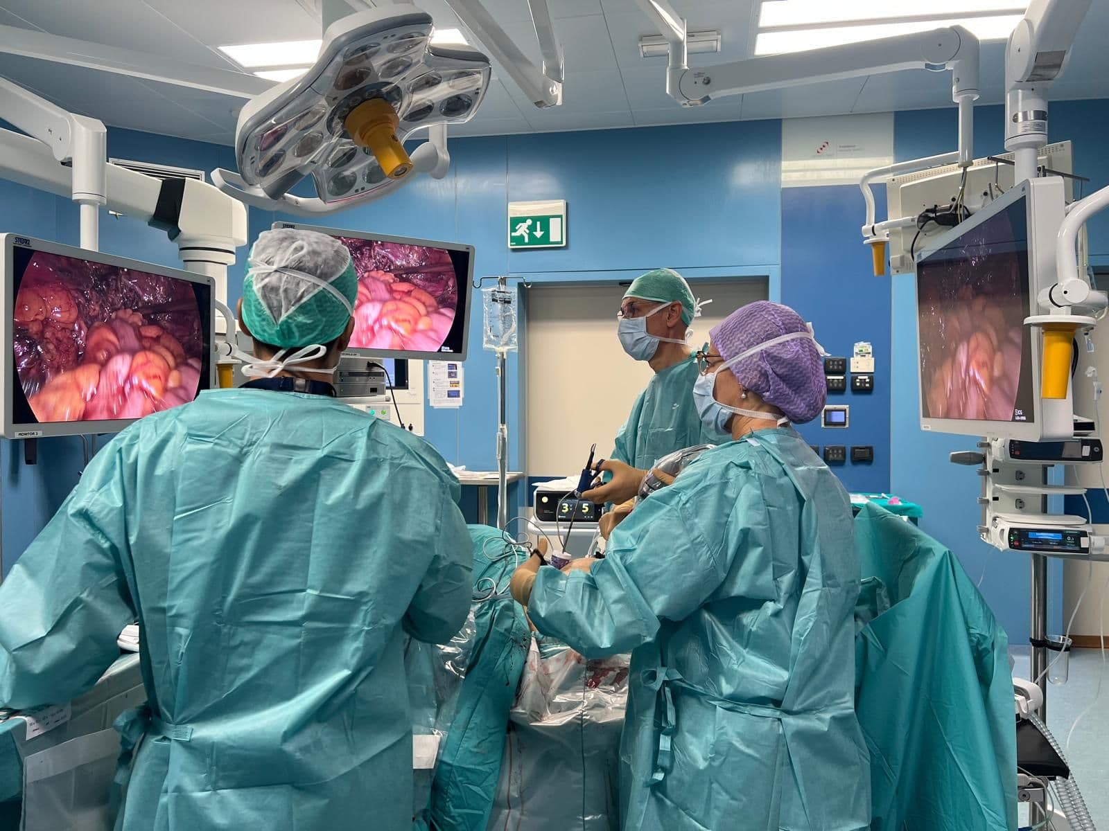 Personale sanitario in sala operatoria durante un intervento laparoscopico, con monitor che mostrano le immagini endoscopiche e apparecchiature chirurgiche disposte intorno al tavolo operatorio.